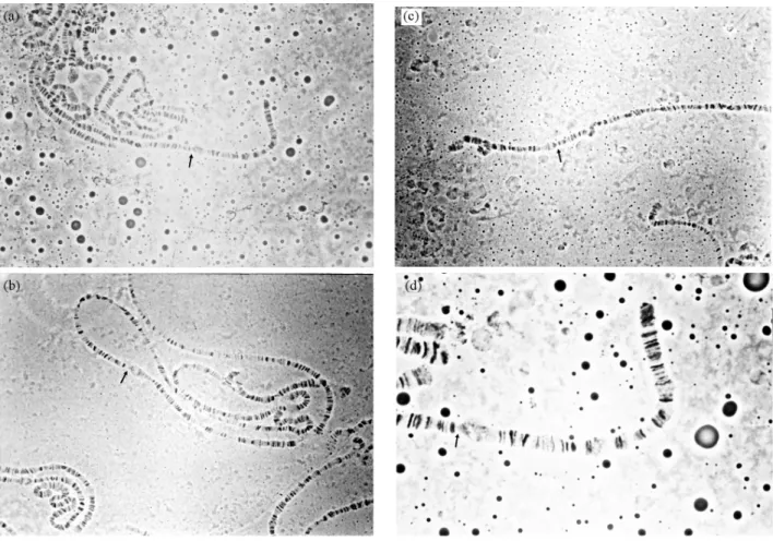 Figure 4 - Different pictures where the constriction located near the O 5 inversion proximal breakage point (indicated by an arrow) is presented