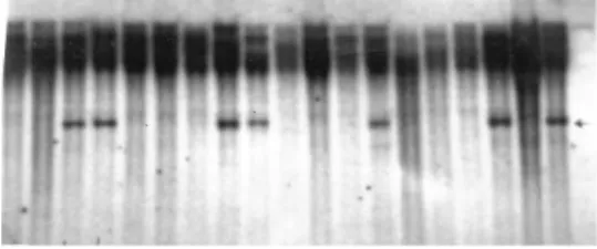 Table 1 - List of cDNA clones, representing expresses sequence tags, used as restriction fragment length polymorphism (RFLP) marker probes.