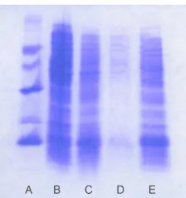 Figura 2.  SDS-PAGE 15% da etapa de indução protéica: (A) Padrão molecular; (B) extrato celular lisado antes  da indução; (C) extrato celular lisado após 3 horas de indução; (D) sobrenadante de cultura antes da indução  (S1); (E) sobrenadante de cultura 3 