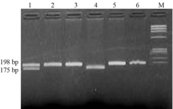Figure 1 - Detection of MTHFR polymorphism. Lanes 2, 3, 5 and 6 show- show-ing wild type (CC) genotype, lane 1 showshow-ing mutant heterozygous (CT) genotype and lane 4 showing mutant homozygous (TT) genotype, M showing molecular weight Marker.