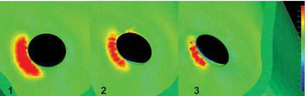 FIGURA 12 - Osso Cortical – Vista inferior (Carga Oblíqua) 