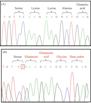 Figure 1 - Electropherogram showing the homozygous insertion in exon 11; from the point of insertion, all following codons convert into other amino acids, resulting in a premature stop codon; (A) normal sequence and (B) homozygous patient.