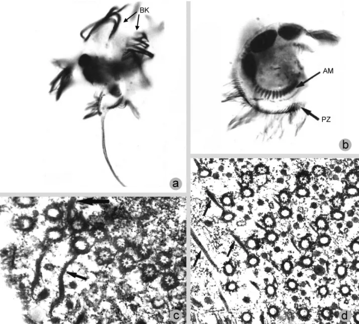 Figure 7 - Micrographs of Caenomorpha medusula, from Santa-Rosa (1975). a-b. Protargol impregnated specimens; c-d