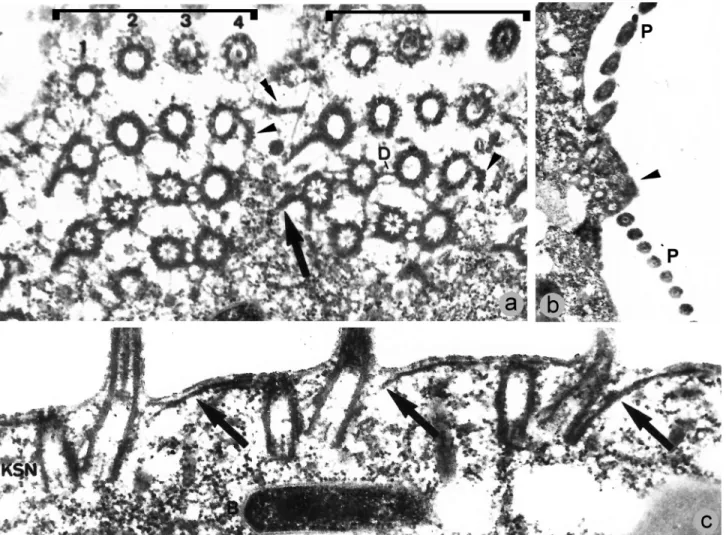 Figure 8 - Transmission electron micrographs of Caenomorpha medusula, from Santa-Rosa (1975)