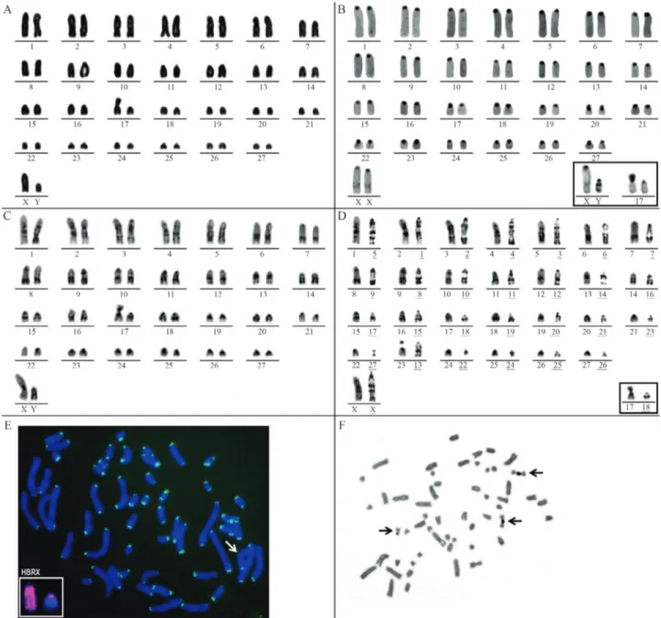 Figure 2 - Karyotype analysis of Pseudoryzomys simplex and comparisons with other species