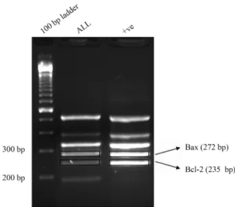 Figure 1 - Agarose electrophoresis results in one of the study samples.