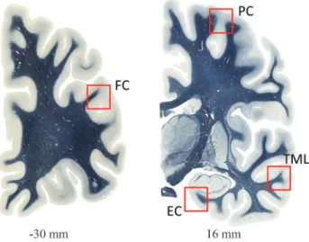 Figure 1 - Human brain sections showing the analyzed areas. Numbers in- in-dicate the position of the sections relative to the center of the anterior commissure