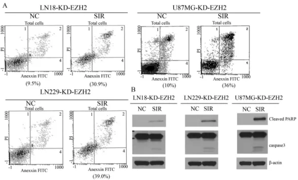 Figure 4 - EZH2 gene silencing promotes cell apoptosis. (A) Flow cytometry results showing apoptosis in three malignant glioma cell lines transfected with EZH2 siRNA