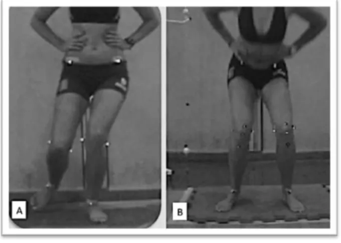 FIGURA 6: Posicionamento do participante para análise do ângulo de projeção frontal  do joelho no agachamento unipodal (a) e aterrissagem do salto vertical (b)