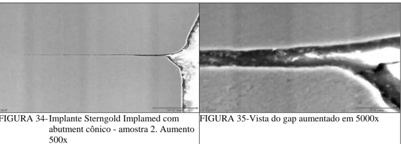 FIGURA 32- Implante Neodent com abutment gold  ucla - amostra 2. Aumento 500x 