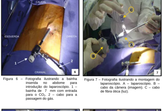 Figura 7 – Fotografia ilustrando a montagem do  laparoscópio. A – laparoscópio. B –  cabo da câmera (imagem)