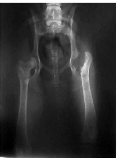 Figura  1  –  Imagem  radiográfica  da  articulação  coxofemoral  de  um  cão,  em  projeção ventro-dorsal, 120 dias após a ostectomia da cabeça e colo femorais,  evidenciando o deslocamento crânio-dorsal do membro operado