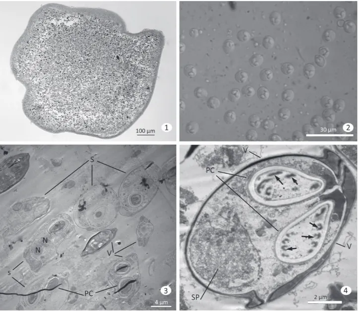 Figs 1-4. Light and transmission electron micrographs of the myxosporean Myxobolus saladensis sp
