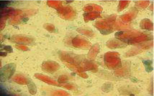 FIGURA  9  -  Fotomicrografia  de  células  coradas  pelo  método  de  Hematoxilina  -  Shorr  pertencente  ao  Grupo  I  (149  dias),  em  aumento  de  400  vezes/campo,  evidenciando  maior  quantidade de células orangeofílicas