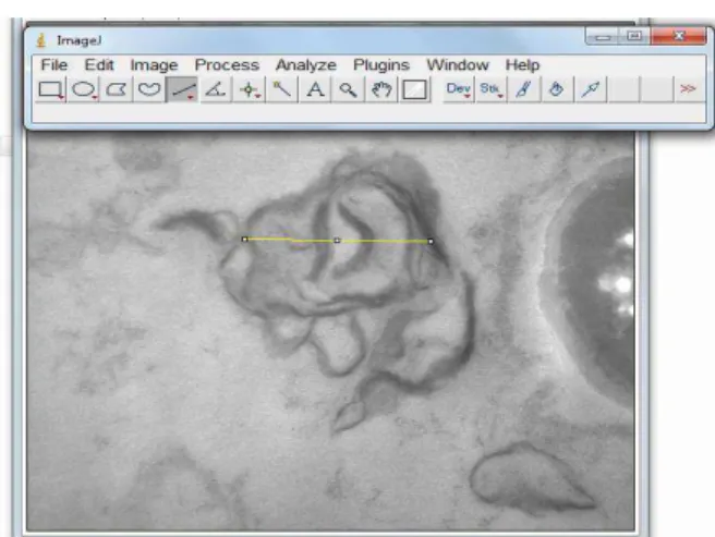 FIGURA 4 – Imagem do programa editor de imagens denominado “Image J®”, utilizado para  mensurar  os  corpos  lamelares