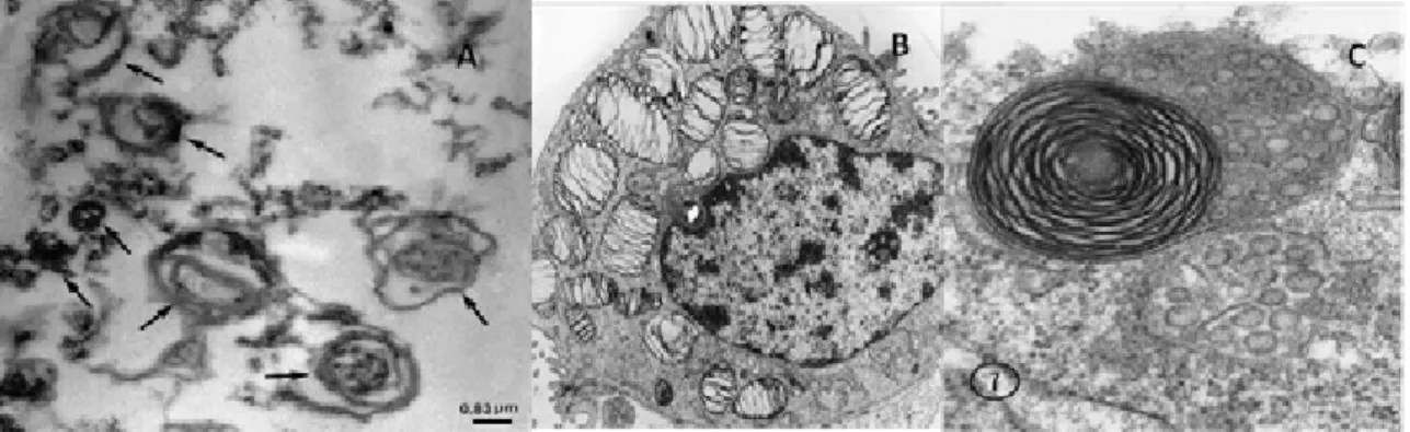 FIGURA 1  –  A)  Microscopia eletrônica evidenciando corpo lamelar em líquido oriundo  da espécie equina medindo 0,83 µm, (CASTAGNETTI, 2007); B)  Microscopia eletrônica de corpo lamelar humano (WONG et al.,1998); C)  Microscopia eletrônica evidenciando co