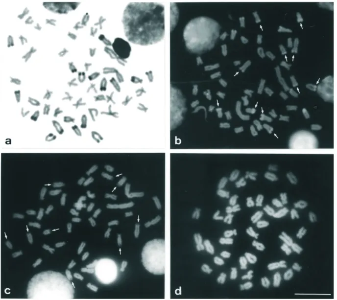 Figure 3 - Metaphase chromosomes of Astyanax scabripinnis from the Centenário population showing distinct responses to different base-specific fluorochromes