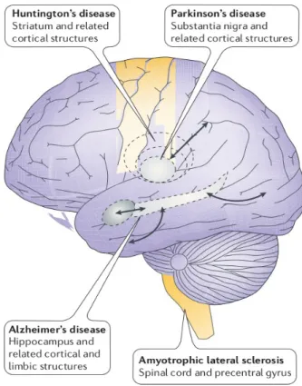 Figure 2. Schematic representation of regional vulnerability in neurodegenerative diseases