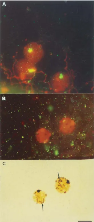 Figure 3 - A) Mapping of the rDNA sequences by FISH during prophase I (early zygotene)