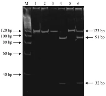 Figure 1 - Detection of the G → T mutation at codon 12 ofHRAS oncogene by PCR-RFLP analysis