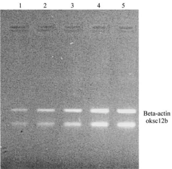 Figure 2 shows a 2% agarose gel separation of PCR products corresponding to the oksc12b gene (160 bp) and the competitor product (262bp)