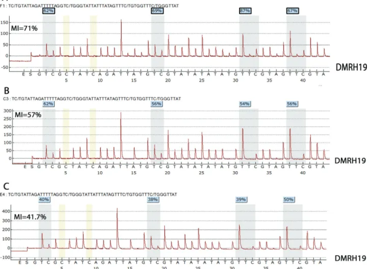 Figure 1 - Pyrogram showing DMRH19 hypermethylation in blood DNA samples from patients P2 (A) and P35 (B)