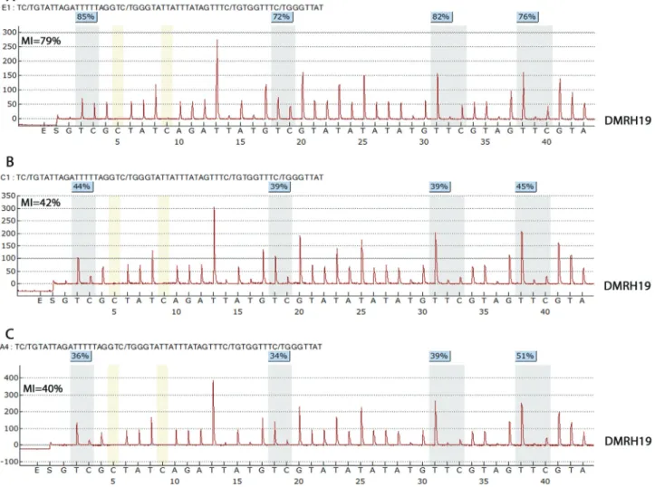 Figure 3 - Pyrogram showing DMRH19 hypermethylation in renal tumor samples from patient P21