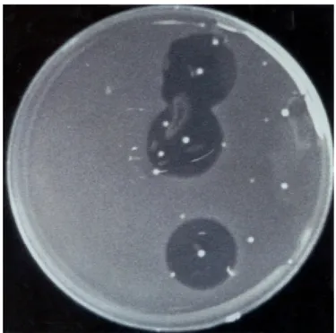 Figure 1: Inhibition zones observed on MRS agar plate from sample of hot-dog A (first sampling time, 10-1 dilution), using Lactobacillus sake ATCC 15521 as indicator microorganism.