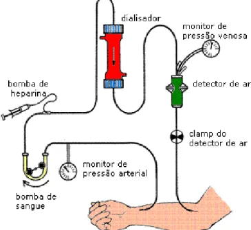 Figura 1 - Esquema do circuito de Hemodiálise 