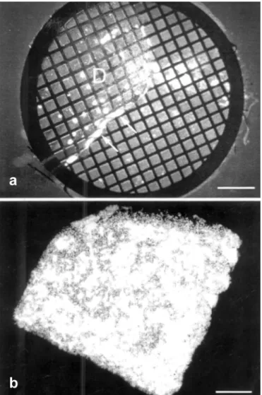 Figure 4. Preparation of magnetotactic bacteria for transmission electron microscopy and electron spectroscopic image