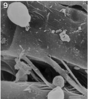 Figure 9. Growth of yeast cells  on the upper  surface of membrane (#245 route) (Bar = 2 nm).