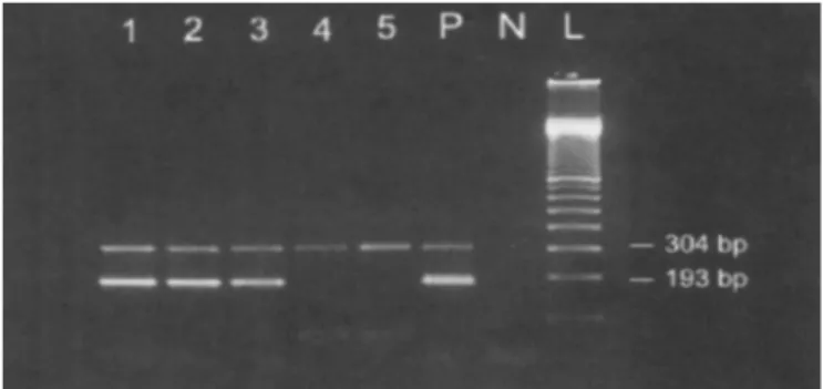 Figure 1. Gel electrophoresis of PCR products, using primers for β-actin and 16S rDNA genes: positive (lanes 1, 2, 3 and 4) for β-actin gene (304 bp); positive control (lane P) with 590 bp (M.