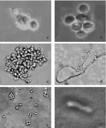 Figure 1. Visualization under the optic microscope: a) globose, yeast-like cell (1000x); b) cell grouping (1000x); c) cell grouping (40x); d) hyphae formation (400x); e) morphological aspect of strain 5 (400x); f) morphological aspect of strain 5 (1000x).