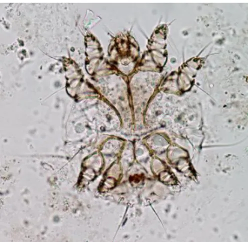 Figura 2- Ovo com uma larva contendo três pares de  patas, no seu interior, 100x (Foto original)