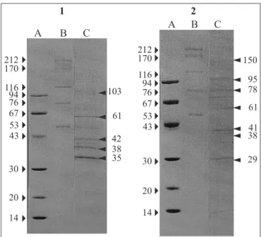 Figure 1. Electrophoretic protein profile in SDS-PAGE 7 to 15%