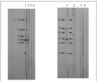 Figure 2. Western blot: reactivity profile of sera of pregnant women for M. penetrans (A) and M