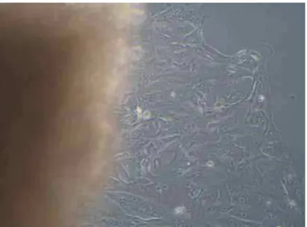 Figura 2 – Imagem de microscopia de luz invertida mostrando explante de tumor mamário de cadela,  aderido ao fundo da garrafa, liberando células que também se aderem ao fundo para continuar  a proliferação