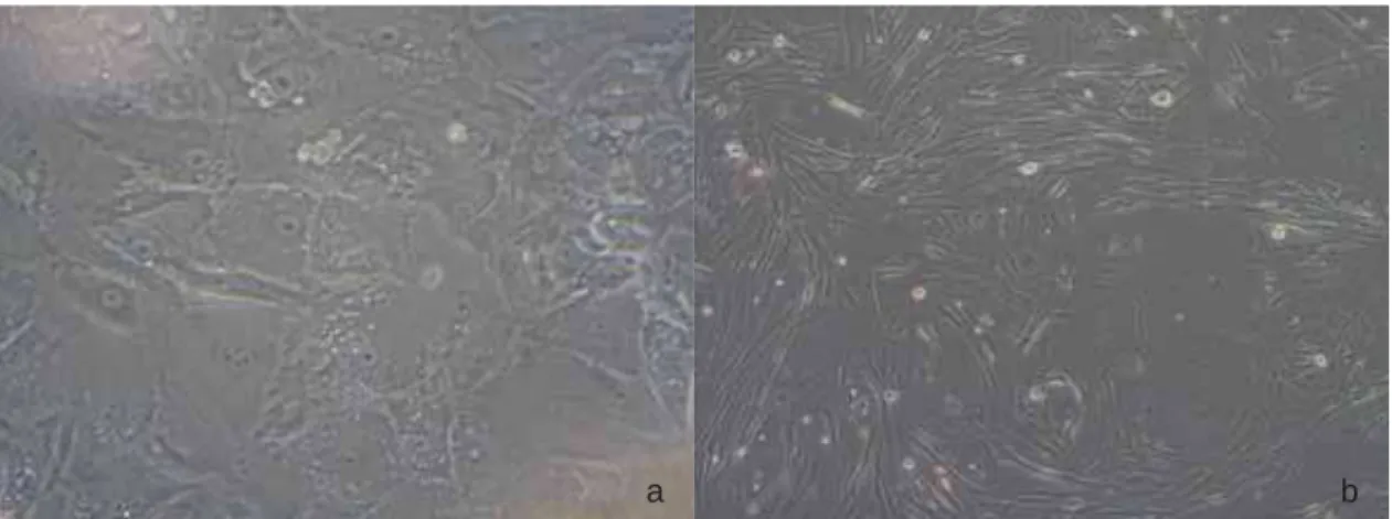 Figura 6 – Imagem de microscopia de luz invertida de carcinoma em tumor misto (a) evidenciando células  epitelióides, com características de malignidade como pleomorfismo, binucleação nucléolos  evidentes e múltiplos