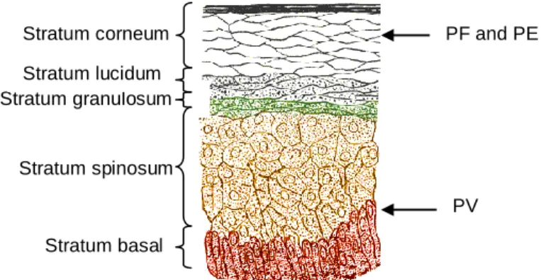 Figure 1. Location of Pemphigus lesions within epidermis in cats. PF and PE pustules form beneath or within the  stratum  corneum