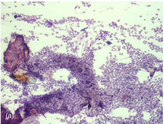 Figure  11.  Cytology  from  under  crusts  around  claw  folds, from the cat of Figure 3, stained with Diff-Quick