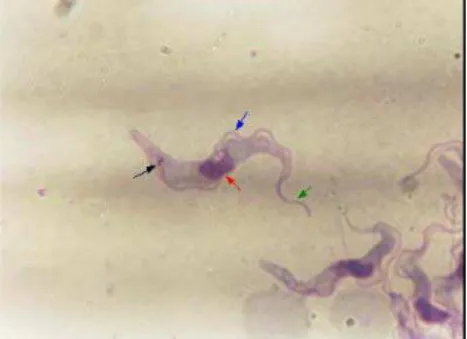 Figura 04. Trypanosoma cruzi - forma tripomastigota. Seta preta - cinetoplasto; vermelha - núcleo; 