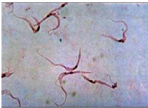 Figura 06. Trypanosoma cruzi – forma amastigota. Fibras musculares cardíacas (hematoxilina/eosina)  infestadas pelo T