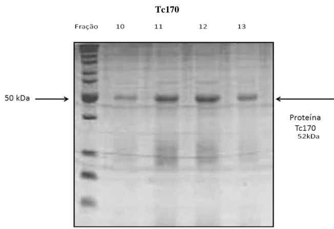 Figura  12:  Frações  da  purificação  por  cromatografia  de  afinidade  da  proteína  Tc170