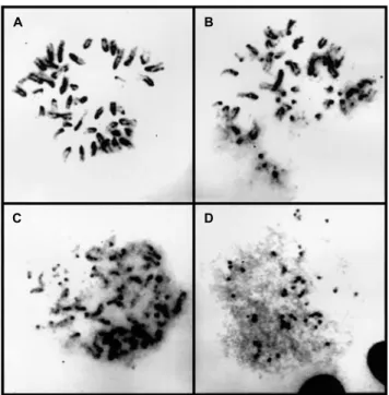 Figure 3 - Bleomycin-treated, Giemsa-stained K-1735 cells showing the initiated (A), intermediate (B and C) and final (D) stages of chromosomal disintegration