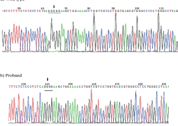 Figure 2 - Sequence analysis of COL1A1 from a wild-type control and the same DNA region from the proband containing the mutation