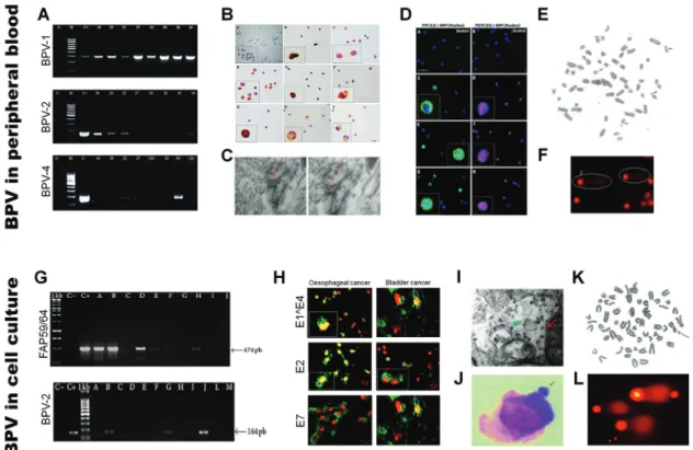 Figure 3 - Evidences of BPV presence in peripheral blood and cell culture showing: A) amplicon of BPV identified using specific primers for BPV-1, 2 and 4 (Araldi et al., 2013); B) BPV genome identification by chromogenic in situ hybridization (Melo et al.