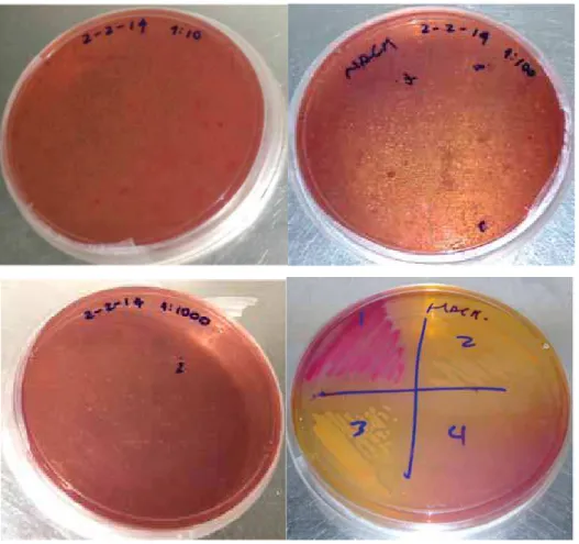 Figura 9. Placas contendo meio seletivo ágar MacConkey mostrando isolamento das  diferentes espécies bacterianas 