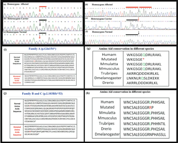 Figure 3 - Sequence analysis of WNT10B gene showing a novel nonsense variant (c.460C > G, p.Gln154*) in affected individuals in family A and B