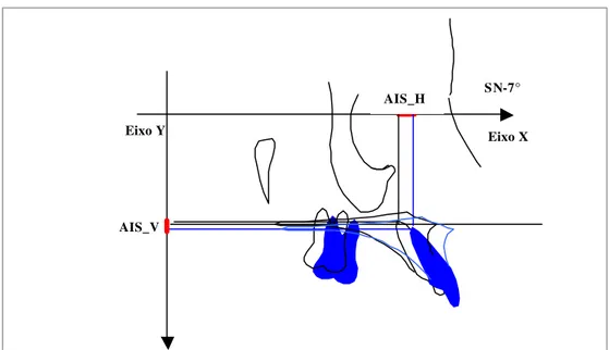 Figura 21 - Superposição regional maxilar para obtenção da movimentação                           total do ápice do incisivo superior