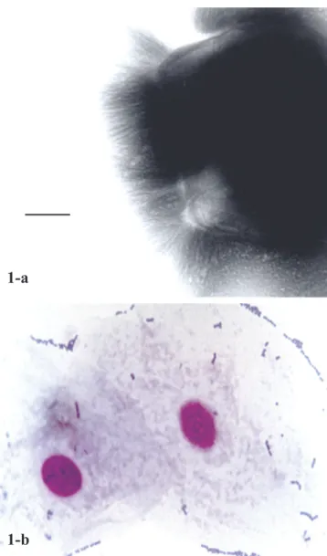 Figure 1. 1-a – C8 strain negatively stained, showing lateral tufts of fibrils on one side of each cell